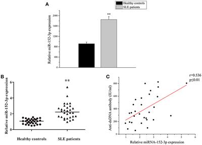 Excessive miR-152-3p Results in Increased BAFF Expression in SLE B-Cells by Inhibiting the KLF5 Expression